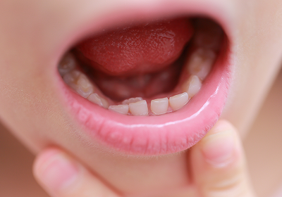 小児歯科の特徴