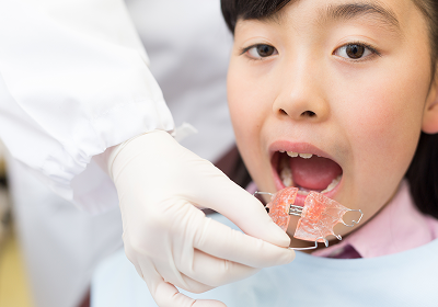 小児歯科の特徴