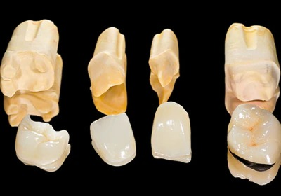 ホワイトニング